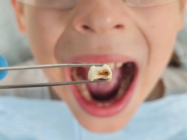 Best Emergency TMJ Treatment in Buckeye Lake, OH